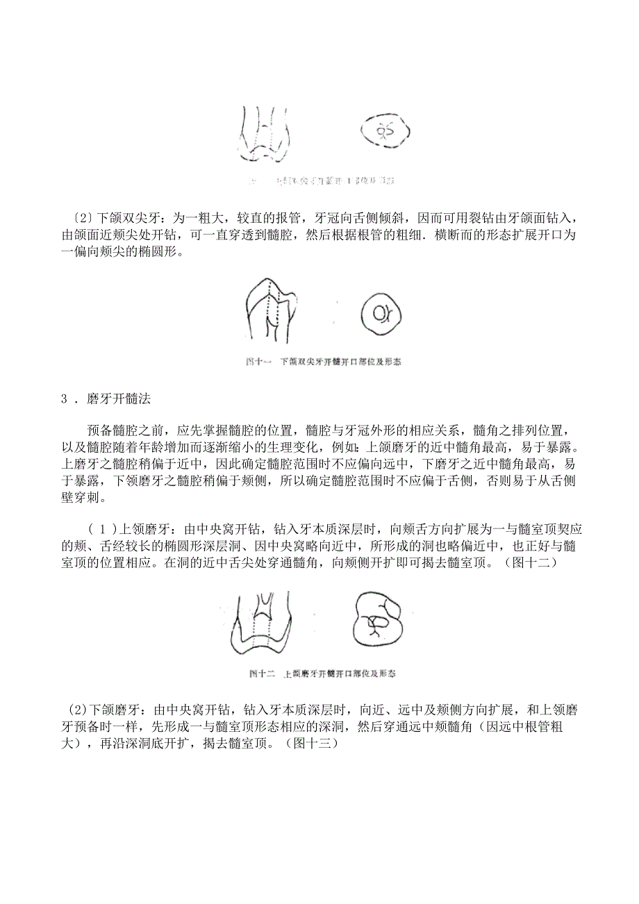 实习一开髓法.doc_第2页