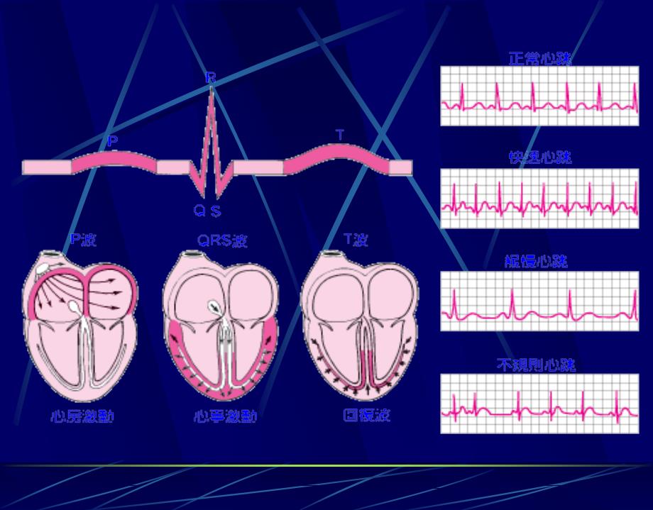 读懂心电PPT课件_第3页