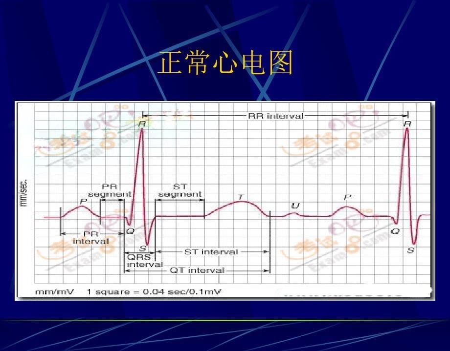 读懂心电PPT课件_第5页