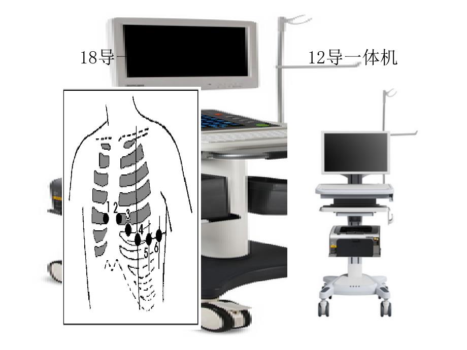 同步18导心电工作站_第2页