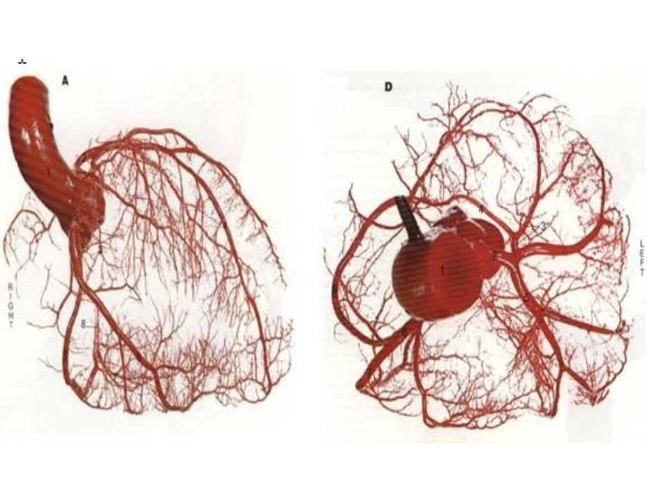 STEMI心电图识别和急诊PCI-医学资料_第3页