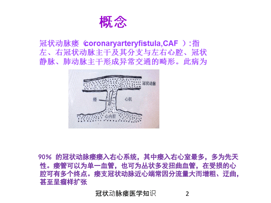 冠状动脉瘘医学知识培训课件_第2页