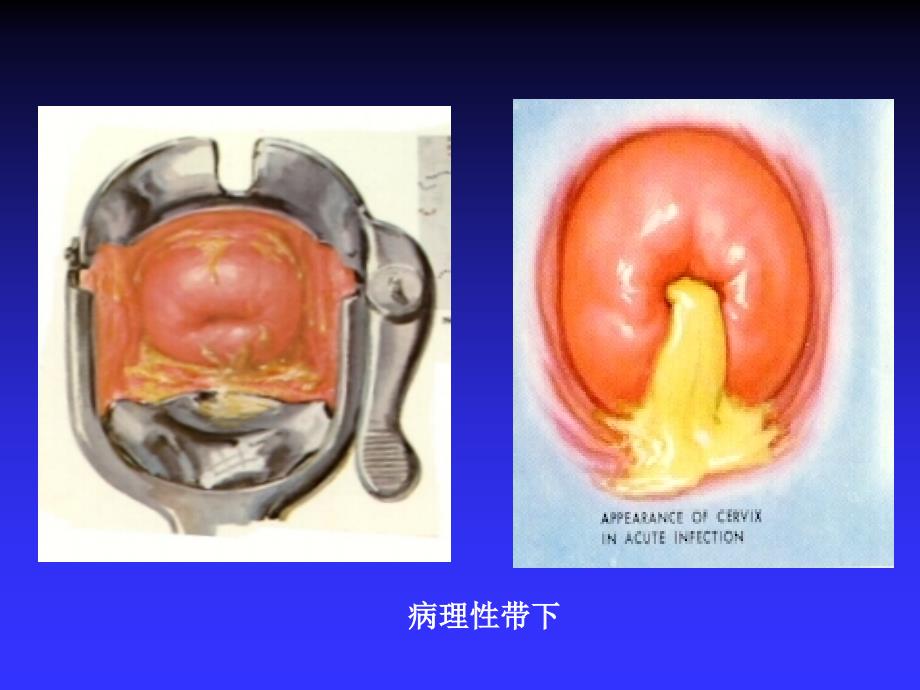 带下病2009简介_第4页