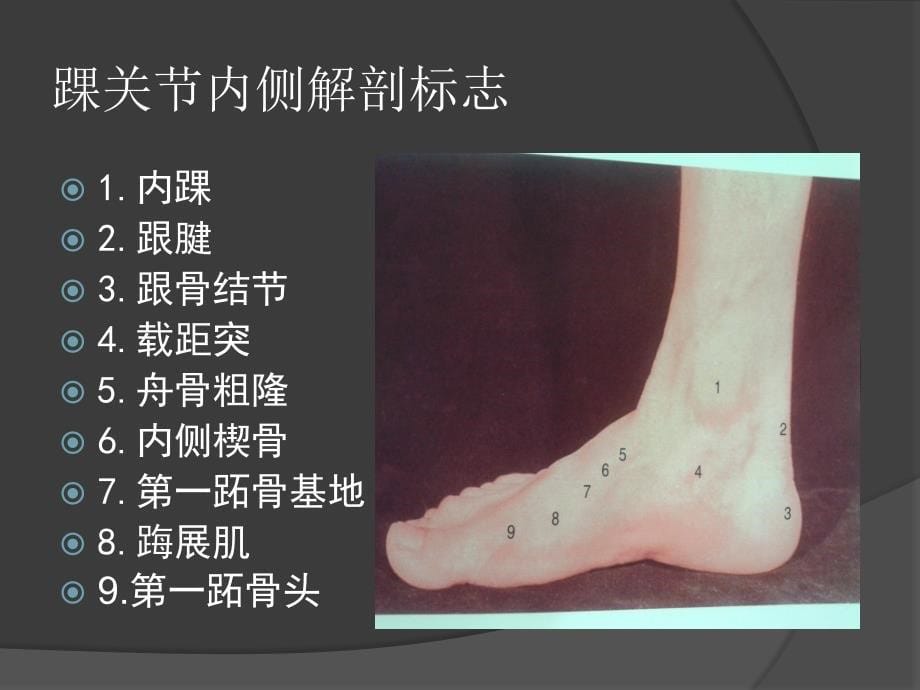 踝关节骨折分型课件.ppt_第5页