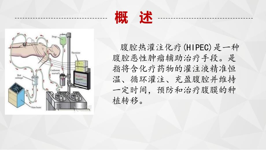 推荐精选腹腔热灌注的作用原理_第3页