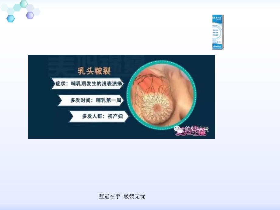 乳头皲裂的日常护_第3页