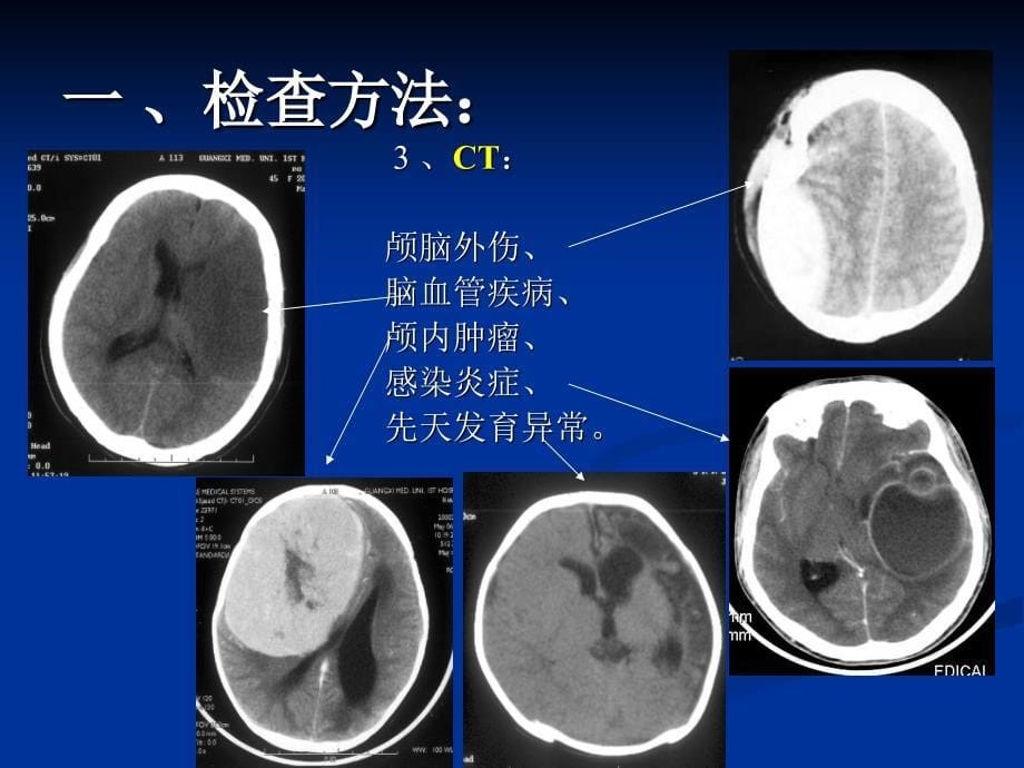 颅脑影像神内ppt课件_第5页