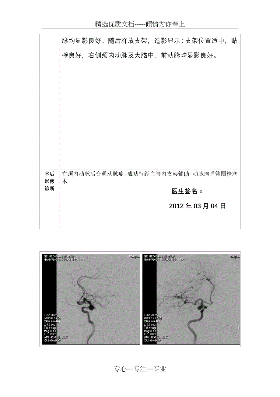 动脉瘤栓塞术报告单_第2页