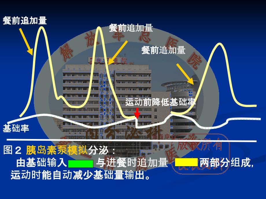 泵治疗的大剂量(马学毅)_第4页