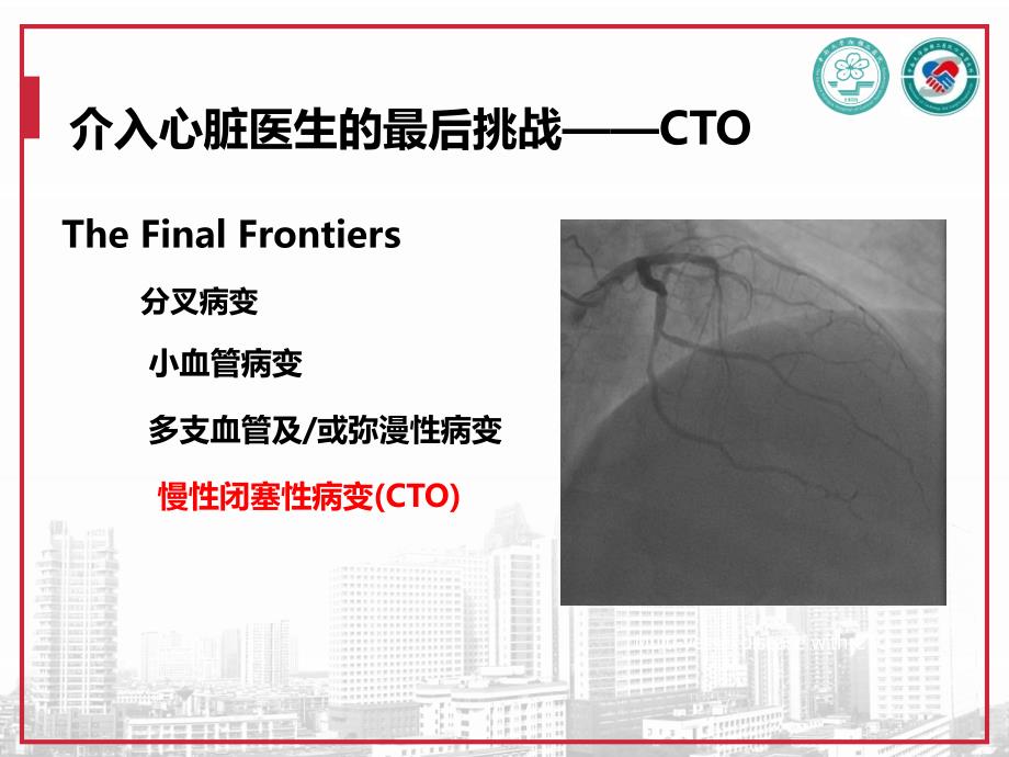 CTO介入治疗处理流程与专家共识_第2页