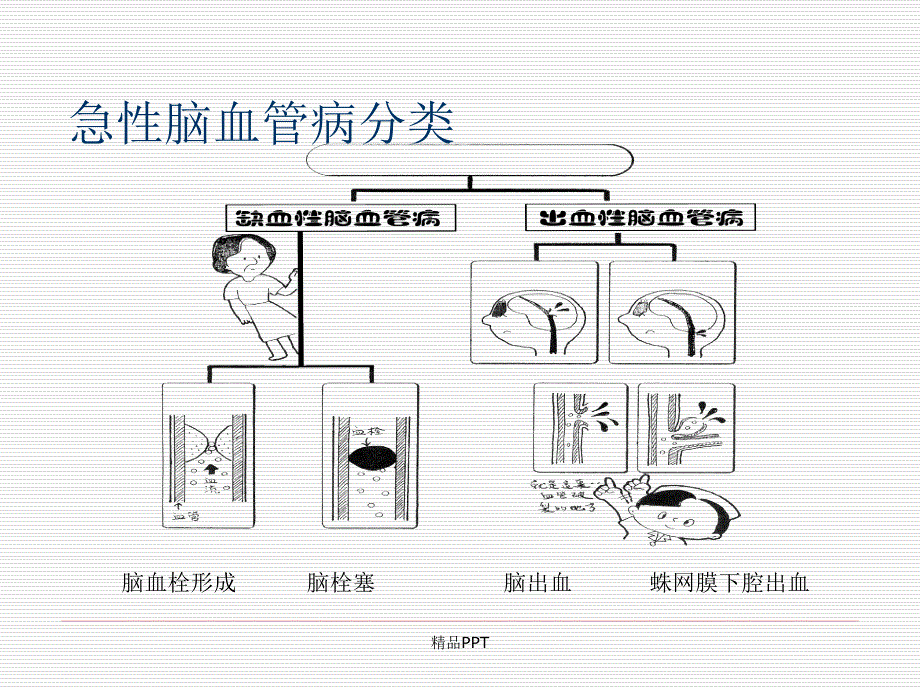 急性脑卒中的识别和急救流程课件_第3页