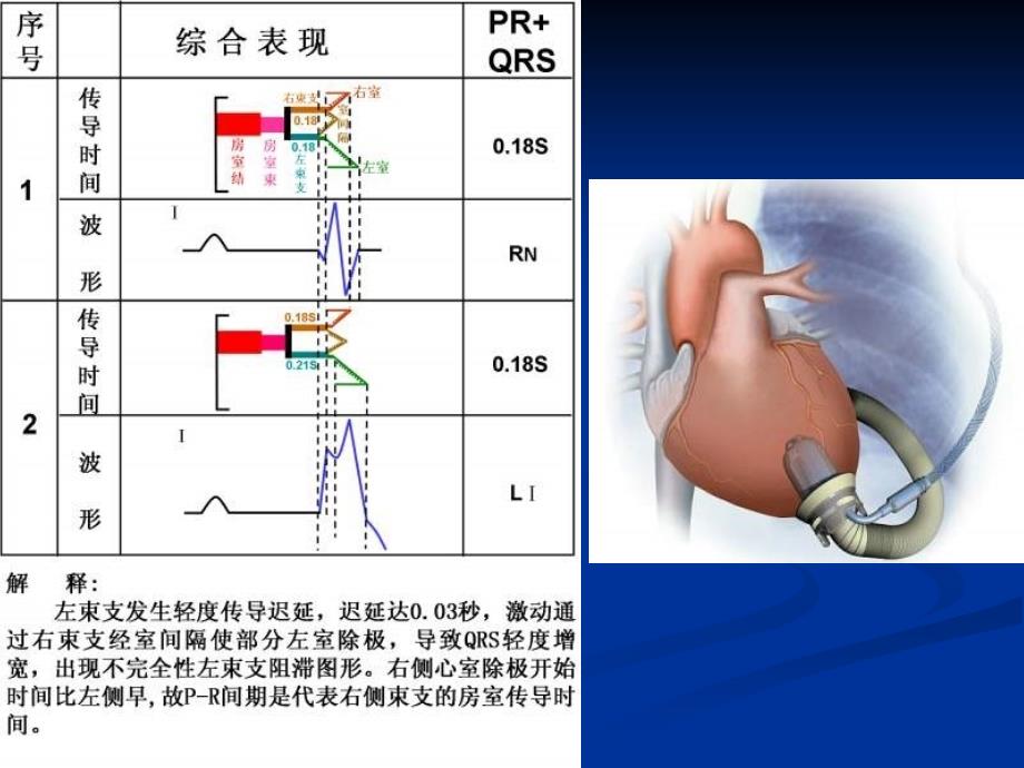 中国医大一院心内科王永权_第4页