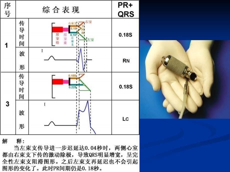 中国医大一院心内科王永权_第5页