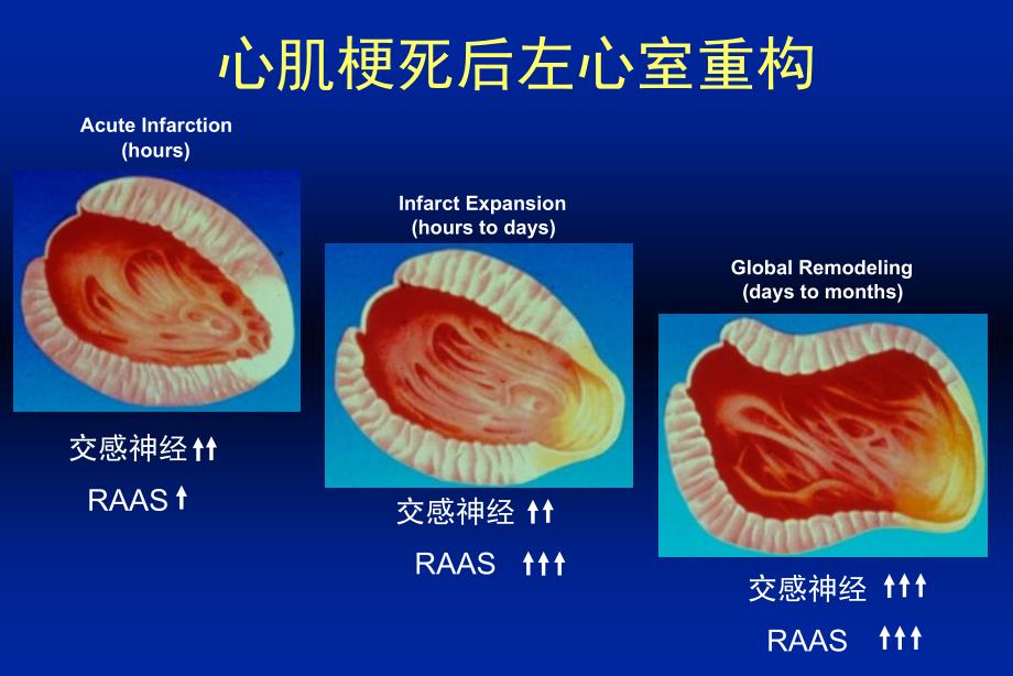 心力衰竭临床药物治疗面临挑战会议课件教学幻灯PPT_第3页