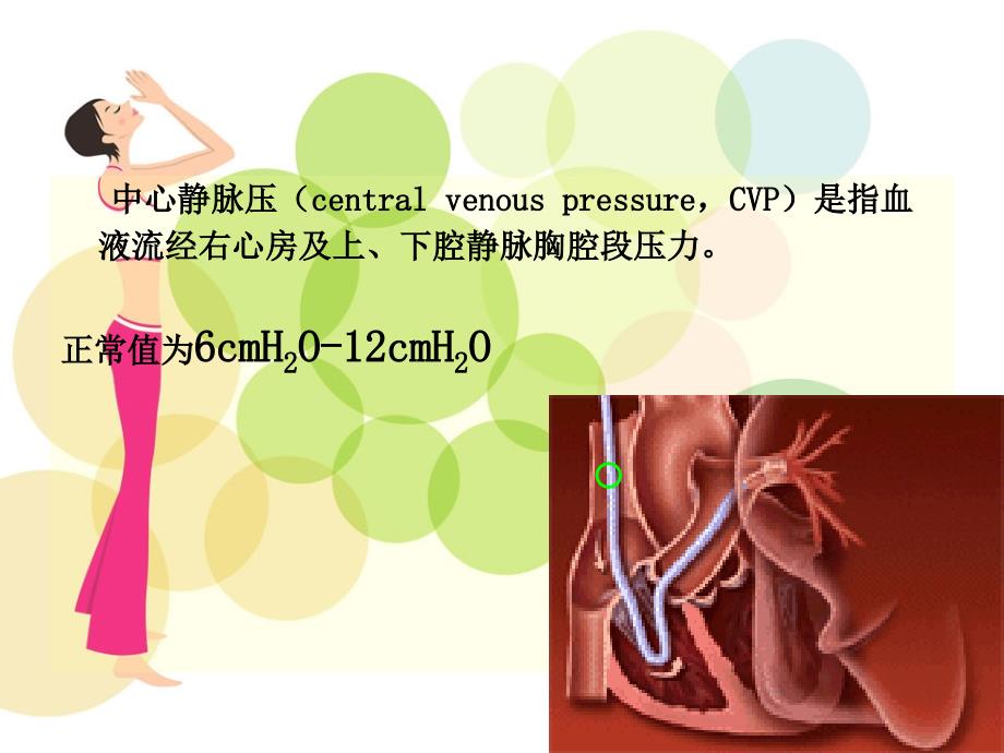 中心静脉压(CVP)监测_第2页