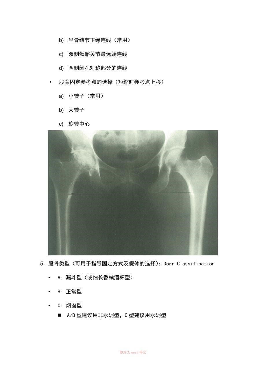 全髋关节置换术术前模板测量步骤及注意事项_第5页