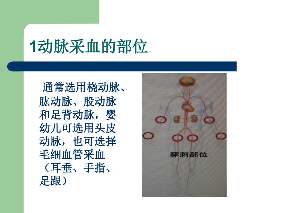 动脉血标本采集_第4页