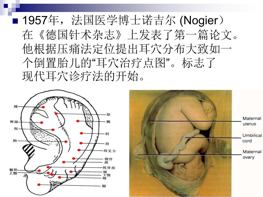 耳穴诊疗在儿童的应用_第3页