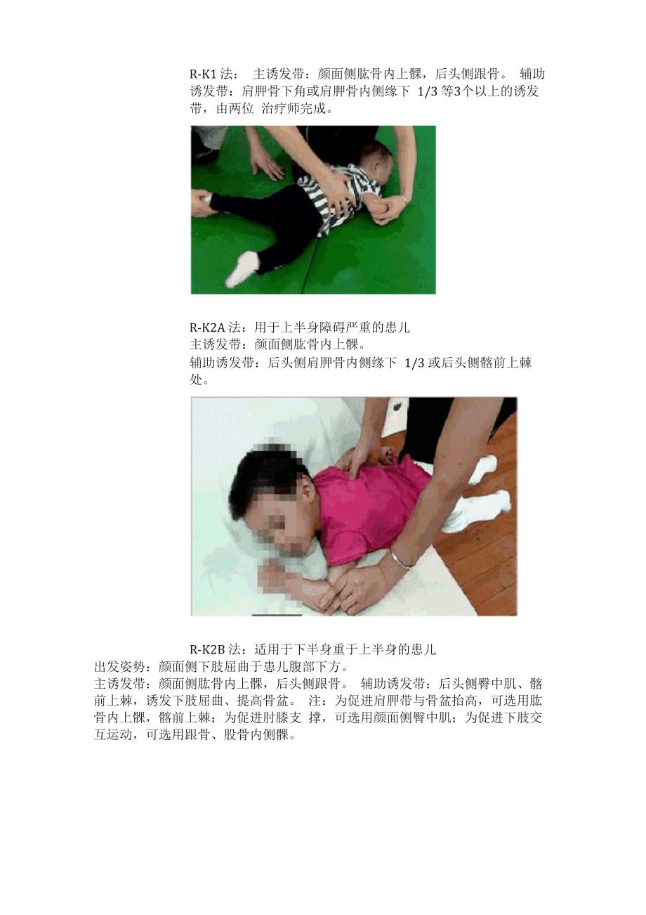 Vojta疗法之反射性腹爬是在俯卧位姿势下_第2页