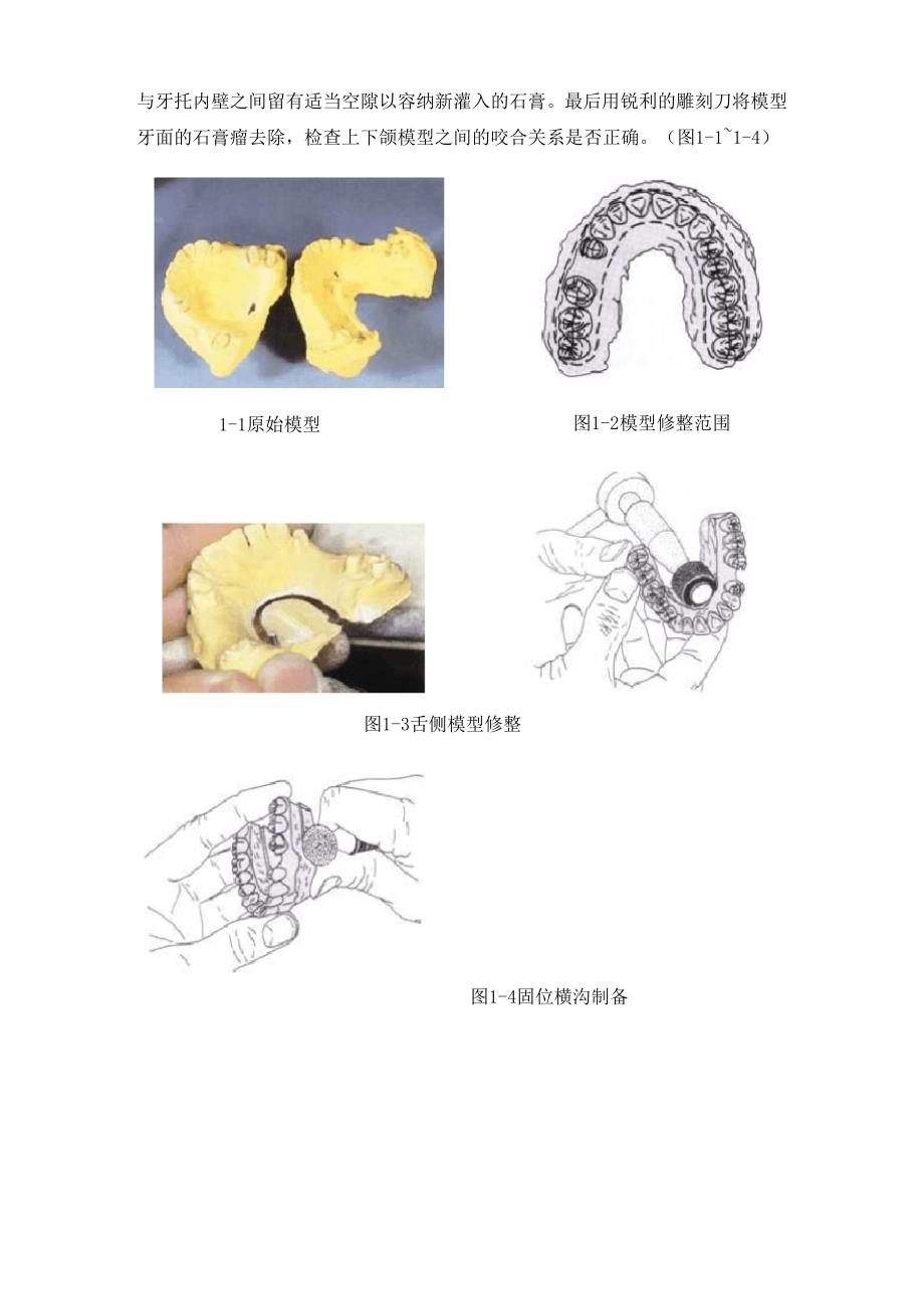 固定义齿工艺技术项目一_第3页