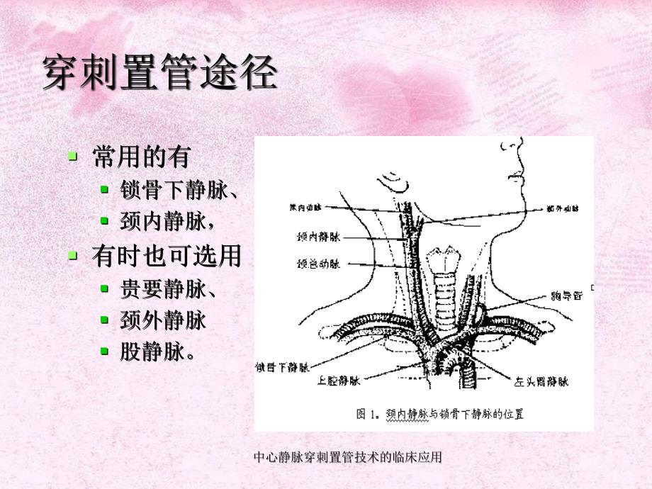 中心静脉穿刺置管技术的临床应用二_第3页