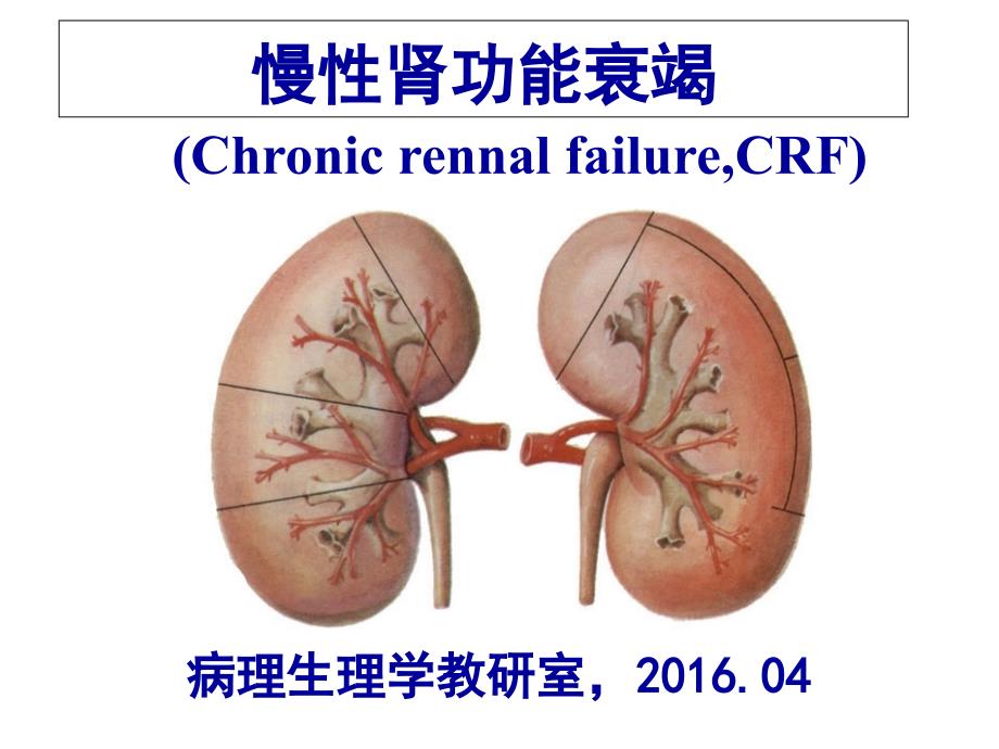 慢性肾功能不全课件_第1页