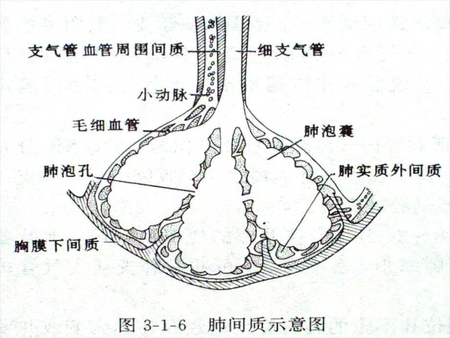 最新肺结核的影像诊断X线17727_第5页