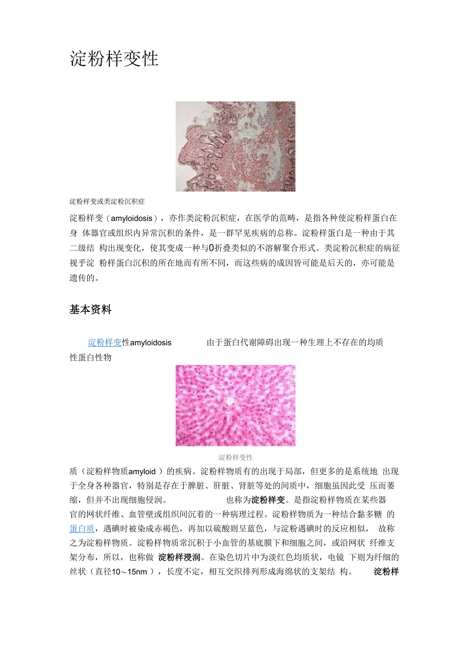 淀粉样变性_第1页