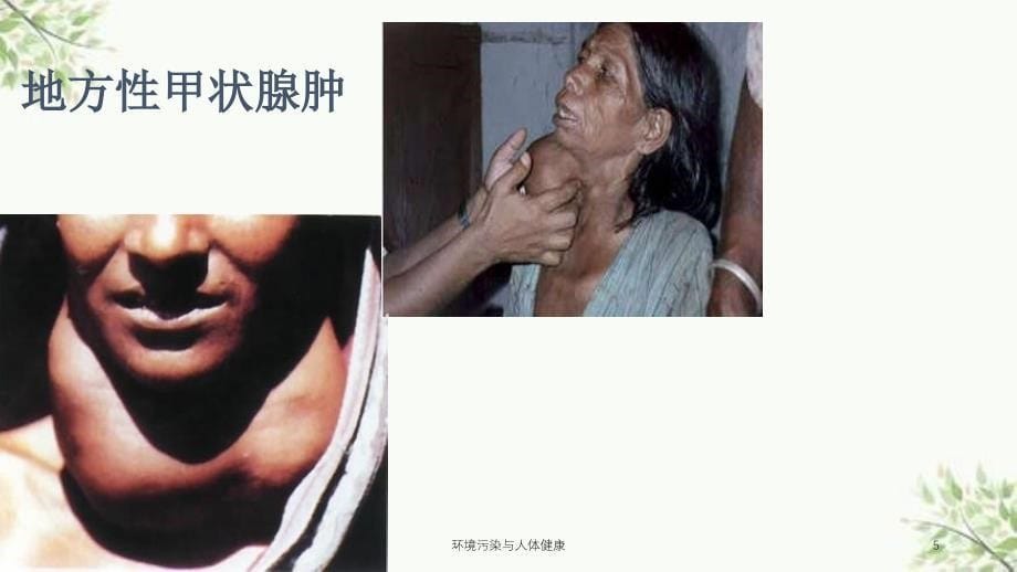 环境污染与人体健康课件_第5页