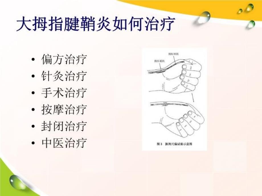 最新大拇指腱鞘炎如何治疗PPT课件_第3页