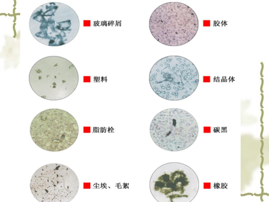 静脉输液微粒的危害及预防_第4页