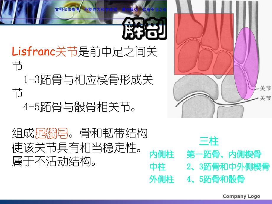 浅析Lisfranc损伤课件_第3页