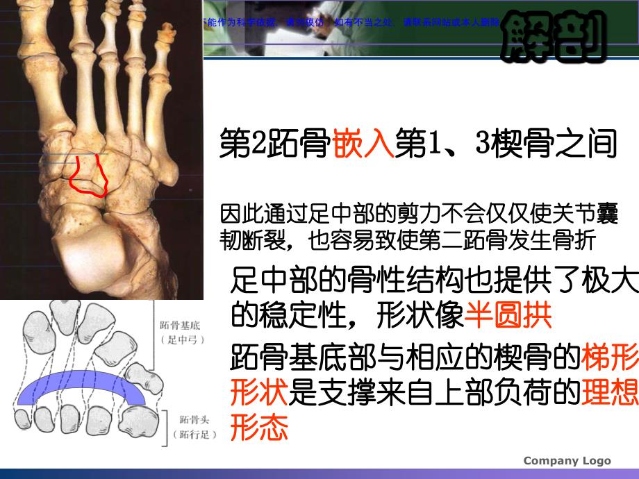 浅析Lisfranc损伤课件_第4页