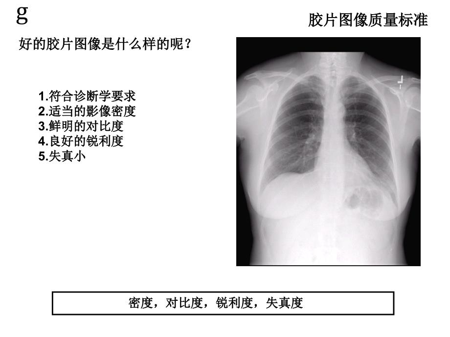 医用X线及胶片图像质量控制基础_第2页