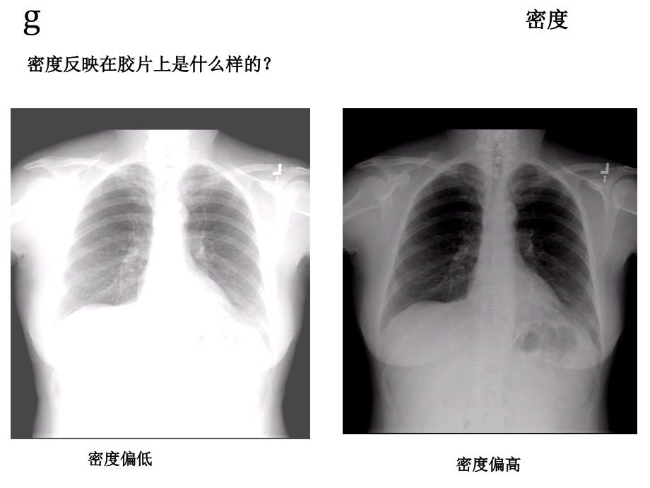 医用X线及胶片图像质量控制基础_第4页