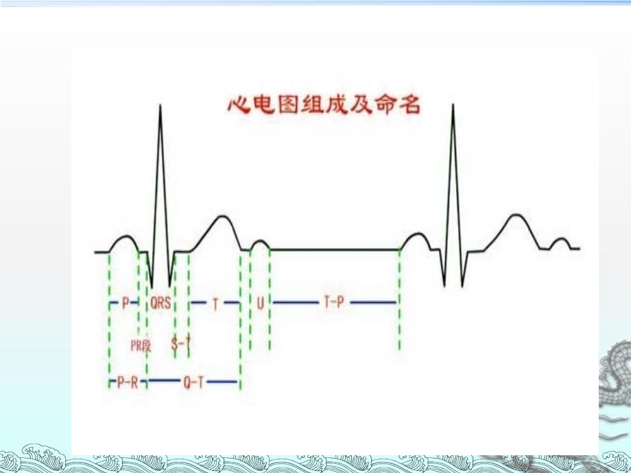 心电图修改版通用课件_第4页