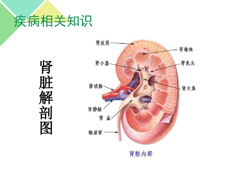 肾癌术后护理查房ppt课件_第2页