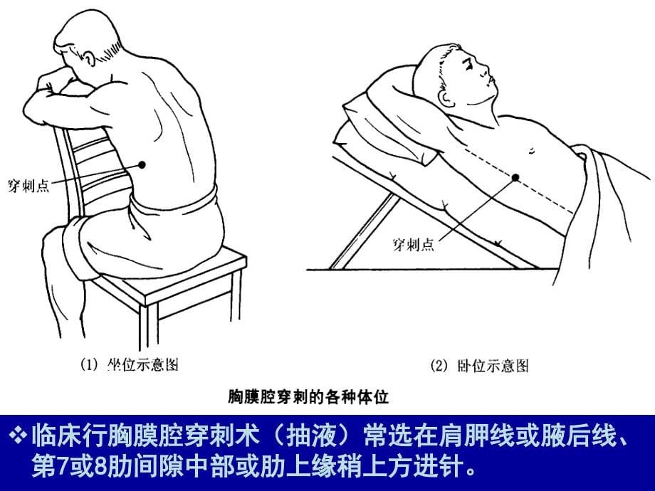 《局部解剖学 》教学课件：13_胸腔 (2)_第5页