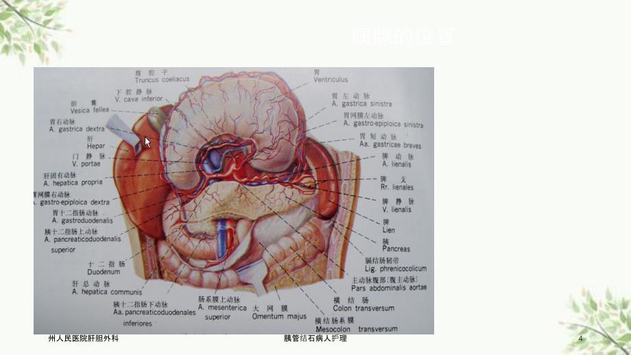 胰管结石病人护理课件_第4页