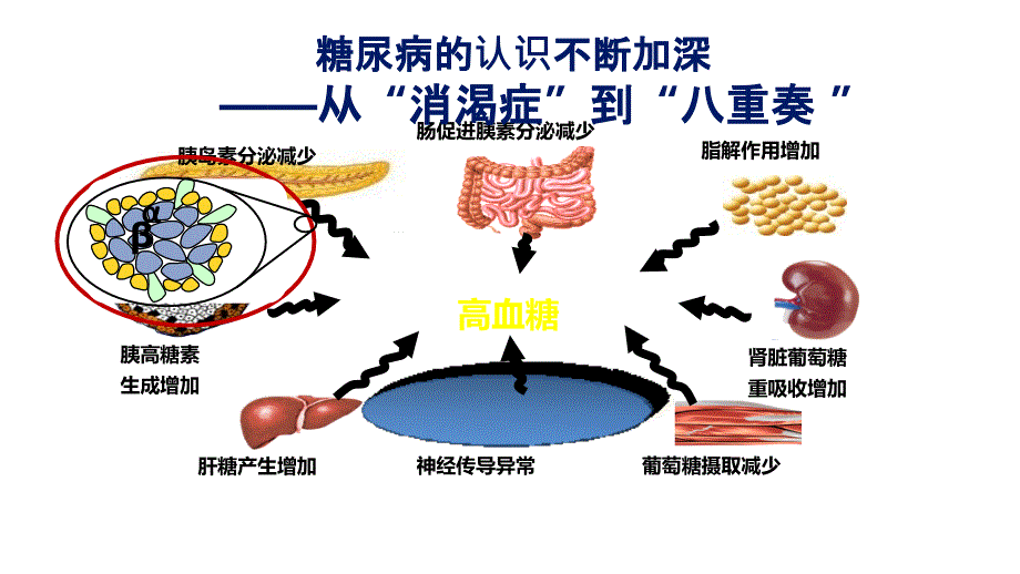 非内分泌患者的血糖管理课件_第4页