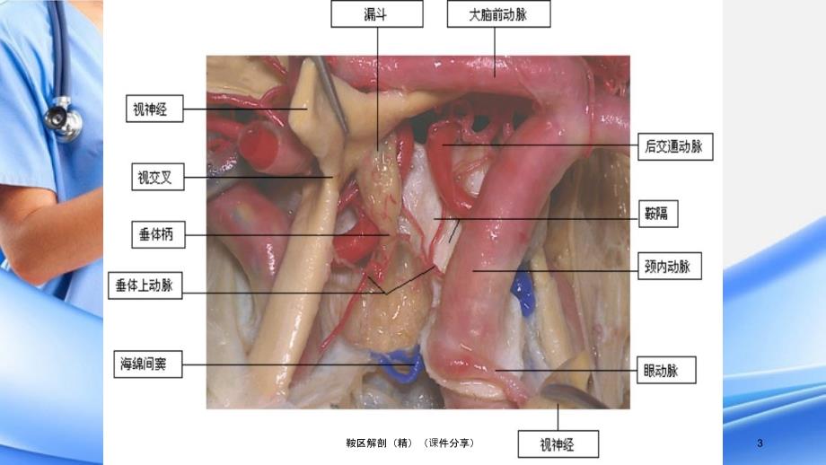 鞍区解剖精课件分享_第3页