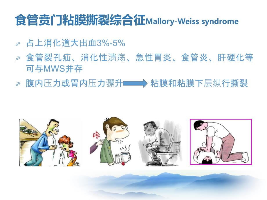 上消化道出血少见病因lcc_第2页