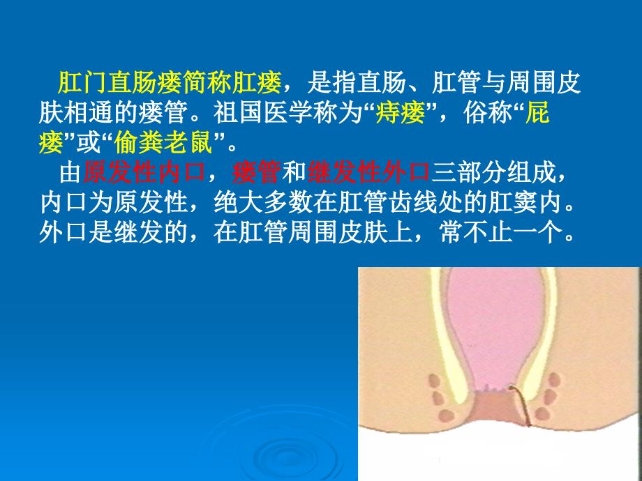 第十章--肛管直肠瘘课件_第2页