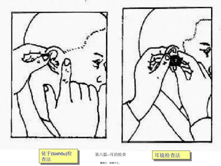 第六篇耳的检查课件_第4页