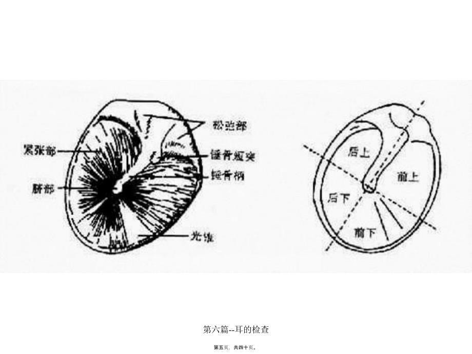 第六篇耳的检查课件_第5页