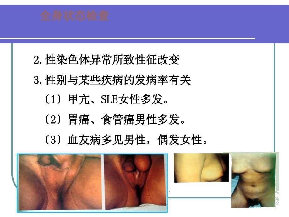 健康评估-课程课件-12一般状态、皮肤、浅表淋巴结_第5页