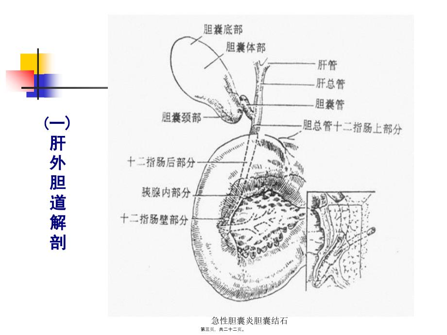 急性胆囊炎胆囊结石课件_第3页