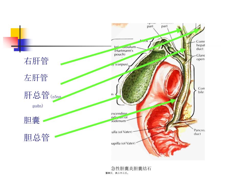 急性胆囊炎胆囊结石课件_第4页