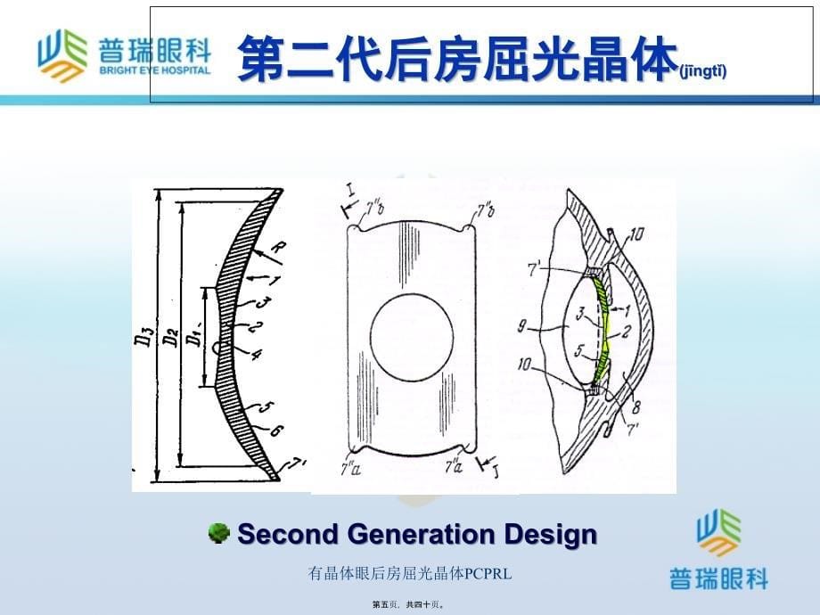 有晶体眼后房屈光晶体PCPRL课件_第5页