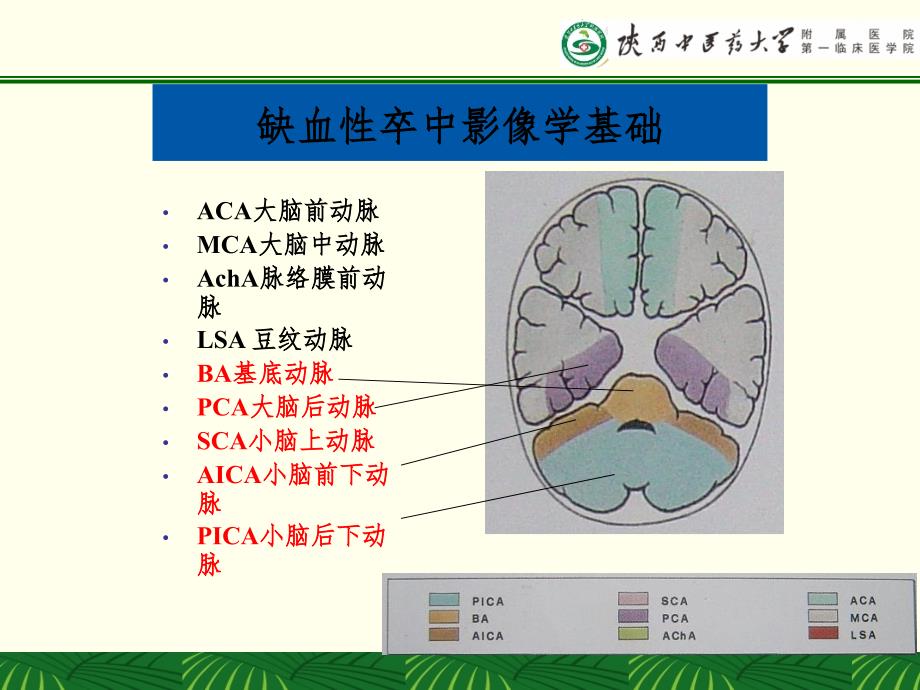 多模CT及磁共振的选择及判读(课堂PPT)_第3页